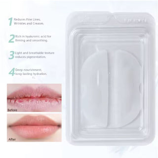 Microneedle Lip Patch – Deep Hydration, Plumping & Line-Smoothing Treatment