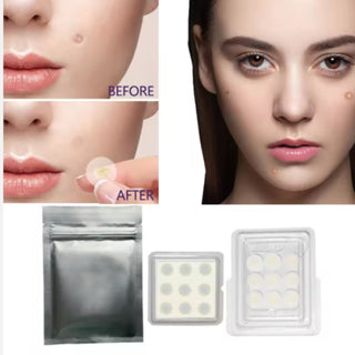 Microneedle Acne Spot Patch – Fast Healing, Scar-Reducing Hydrocolloid Dots
